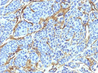 Monoclonal Antibody to NGF-Receptor (p75) / CD271 (Soft Tissue Tumor Marker)(Clone : NTR/912)