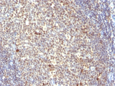 Monoclonal Antibody to Nuclear Mitotic Apparatus Protein (NuMA)(Clone : SPM300)