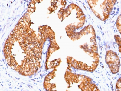 Monoclonal Antibody to Ornithine Decarboxylase-1 (ODC-1)(Clone : ODC1/485)