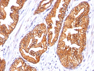 Monoclonal Antibody to Ornithine Decarboxylase-1 (ODC-1)(Clone : SPM565)