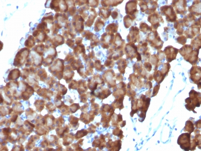 Monoclonal Antibody to Ornithine Decarboxylase-1 (ODC-1)(Clone : ODC1/486)