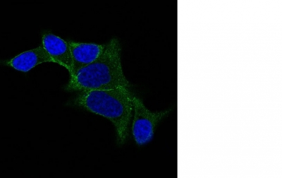 Monoclonal Antibody to Ornithine Decarboxylase-1 (ODC-1)(Clone : ODC1/487)