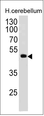 Monoclonal Antibody to PAX6 (Stem Cell Marker)(Clone : PAX6/498)