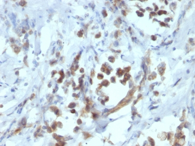 Monoclonal Antibody to PAX6 (Stem Cell Marker)(Clone : PAX6/1166)