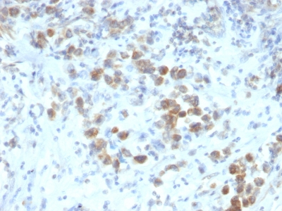 Monoclonal Antibody to PAX6 (Stem Cell Marker)(Clone : SPM612)