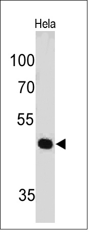 Monoclonal Antibody to PAX7 (Rhabdomyosarcoma Marker)(Clone : PAX7/497)