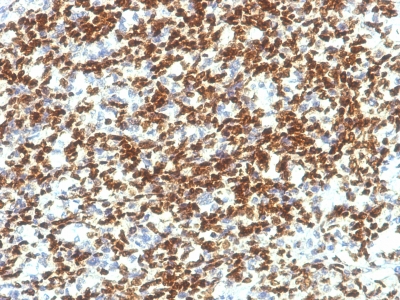 Monoclonal Antibody to PAX7 (Rhabdomyosarcoma Marker)(Clone : PAX7/1187)(Discontinued)