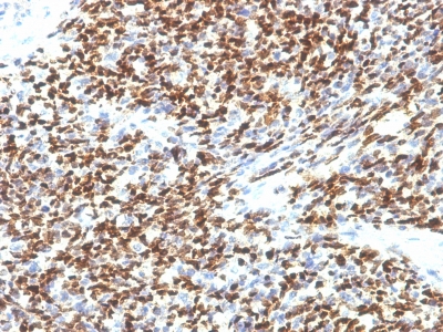 Monoclonal Antibody to PAX7 (Rhabdomyosarcoma Marker)(Clone : SPM613)