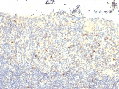 Monoclonal Antibody to FOXP3 (Forkhead Box Protein P3) / Scurfin(Clone : FXP3/197)