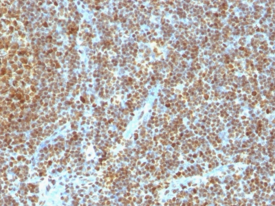 Monoclonal Antibody to PCNA (Proliferating Cell Nuclear Antigen) (G1- & S-phase Marker)(Clone : SPM350)