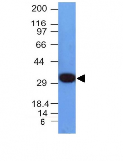 Monoclonal Antibody to PCNA (Proliferating Cell Nuclear Antigen) (G1- & S-phase Marker)(Clone : PCNA/694)