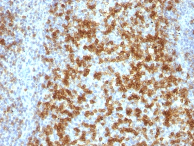 Monoclonal Antibody to PD1 / PDCD1 / CD279 (Programmed Cell Death 1)(Clone : PDCD1/922)