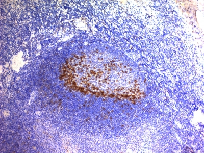 Monoclonal Antibody to PD1 / PDCD1 / CD279 (Programmed Cell Death 1)(Clone : SPM597)