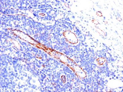 Monoclonal Antibody to CD31 / PECAM-1 (Endothelial Cell Marker)(Clone : C31.3)