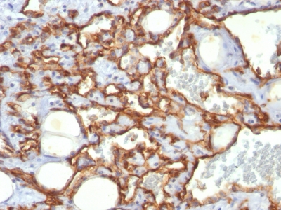 Monoclonal Antibody to CD31 / PECAM-1 (Endothelial Cell Marker)(Clone : SPM532)