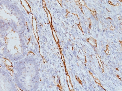 Monoclonal Antibody to CD31 / PECAM-1 (Endothelial Cell Marker)(Clone : JC/70A)