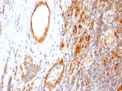 Monoclonal Antibody to CD31 / PECAM-1 (Endothelial Cell Marker)(Clone : 1A10)