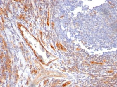 Monoclonal Antibody to CD31 / PECAM-1 (Endothelial Cell Marker)(Clone : C31.10)