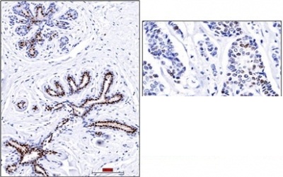 Monoclonal Antibody to Progesterone Receptor (Marker of Progestin Dependence)(Clone : PR501)