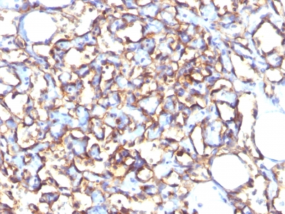 Monoclonal Antibody to Podocalyxin (PODXL) (Hematopoietic Stem Cell Marker)(Clone : 3D3)