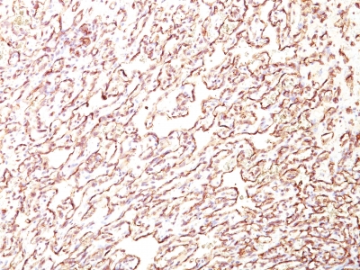 Monoclonal Antibody to Podocalyxin (PODXL) (Hematopoietic Stem Cell Marker)(Clone : 4F10)