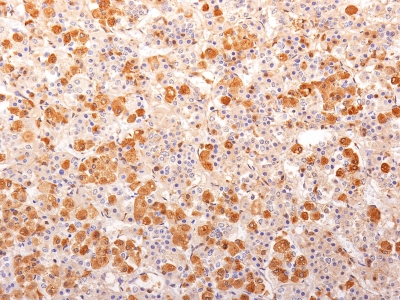 Monoclonal Antibody to ACTH (Adrenocorticotrophic Hormone) (Pituitary Marker)(Clone : 57)