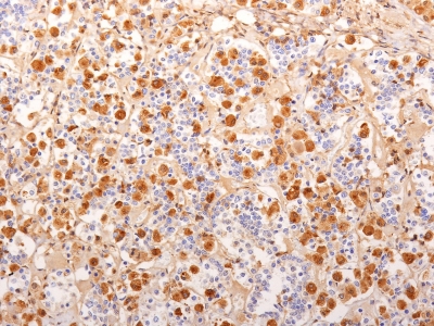 Monoclonal Antibody to ACTH (Adrenocorticotrophic Hormone) (Pituitary Marker)(Clone : 2F6)