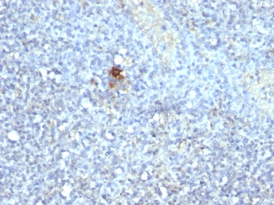 Monoclonal Antibody to TRAcP (Tartrate-Resistant Acid Phosphatase) (Hairy Cell Leukemia Marker)(Clone : ACP5/