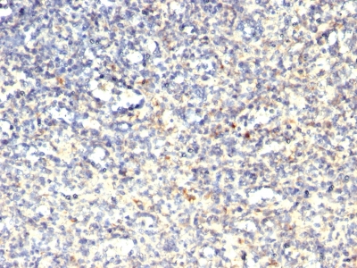 Monoclonal Antibody to TRAcP (Tartrate-Resistant Acid Phosphatase) (Hairy Cell Leukemia Marker)(Clone : SPM60