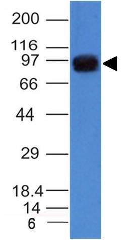 Monoclonal Antibody to UACA / Nucling (Nuclear Membrane Marker)(Clone : UACA/1222)