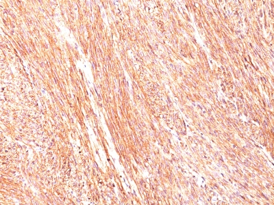 Monoclonal Antibody to DOG-1 / TMEM16A (Gastrointestinal Stromal Tumor Marker)(Clone : DG1/447)