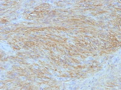 Monoclonal Antibody to DOG-1 / TMEM16A / ANO1 (Gastrointestinal Stromal Tumor Marker)(Clone : SPM580)