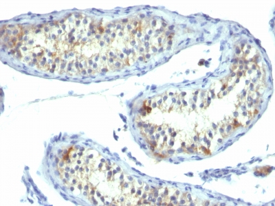 Monoclonal Antibody to Prolactin Receptor (hPRL-Receptor)(Clone : B6.2)