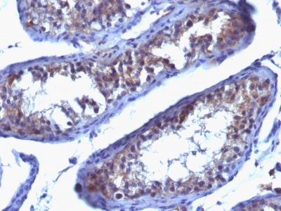 Monoclonal Antibody to Prolactin Receptor (hPRL-Receptor)(Clone : SPM213)