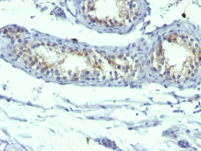 Monoclonal Antibody to Prolactin Receptor (hPRL-Receptor)(B6.2 + PRLR742)