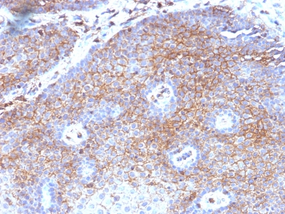 Monoclonal Antibody to Beta-2 Microglobulin (Renal Failure & Tumor Marker)(Clone : B2M/1118)