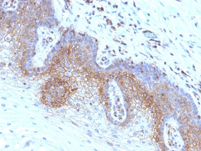 Monoclonal Antibody to Beta-2 Microglobulin (Renal Failure & Tumor Marker)(Clone : SPM617)