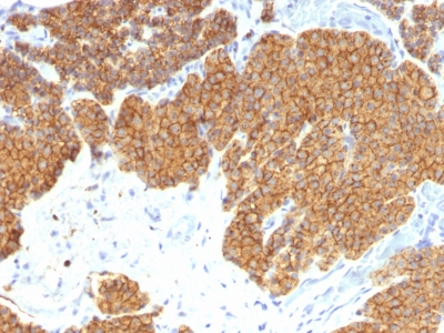 Monoclonal Antibody to Parathyroid Hormone (PTH) (N-Terminal)(Clone : 3H9)