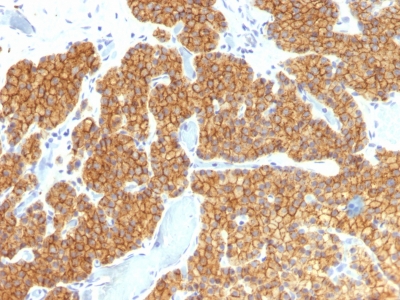 Monoclonal Antibody to Parathyroid Hormone (PTH) (N-Terminal)(Clone : PTH/911)