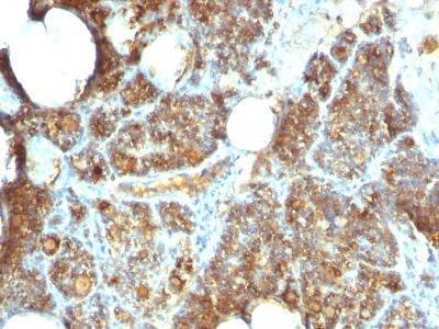 Monoclonal Antibody to Parathyroid Hormone (PTH) (C-Terminal)(Clone : PTH/1173)