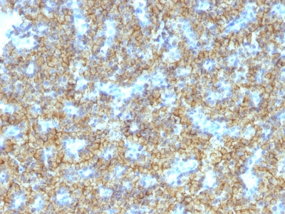 Monoclonal Antibody to Parathyroid Hormone (PTH) (C-Terminal)(Clone : PTH/1174)