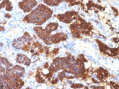 Monoclonal Antibody to Parathyroid Hormone (PTH) (C-Terminal)(Clone : PTH/1175)