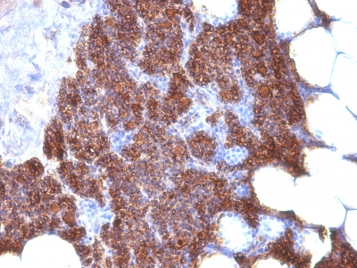 Monoclonal Antibody to Parathyroid Hormone (PTH) (N- & C-Terminal)(3H9 + PTH/1175)