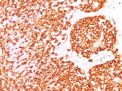 Monoclonal Antibody to CD45RB (B-Cell Marker)(Clone : DF-B1)