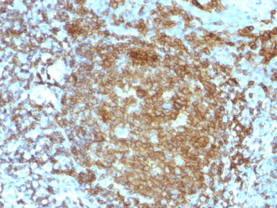 Monoclonal Antibody to CD45RA (Leucocyte Marker)(Clone : PTPRC/818)