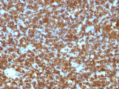 Monoclonal Antibody to CD45RA (Leucocyte Marker)(Clone : PTPRC/1131)