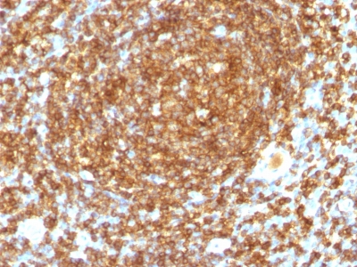 Monoclonal Antibody to CD45RB (B-Cell Marker)(Clone : PTPRC/1132)