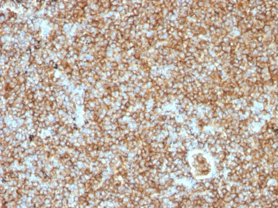 Monoclonal Antibody to CD45RB (B-Cell Marker)(Clone : PTPRC/1147)