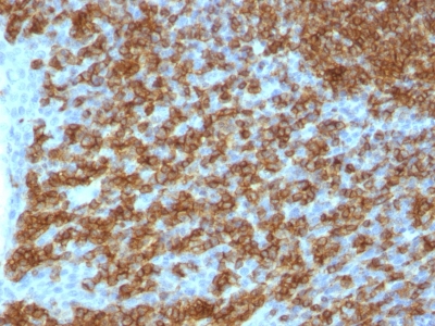 Monoclonal Antibody to CD45RA (Leucocyte Marker)(Clone : PTPRC/1148)