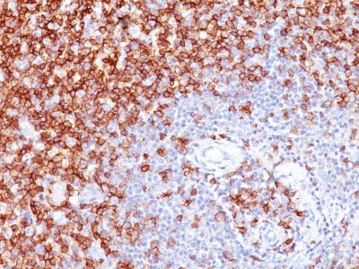 Monoclonal Antibody to CD45RO (T-Cell Marker)(Clone : UCHL-1)